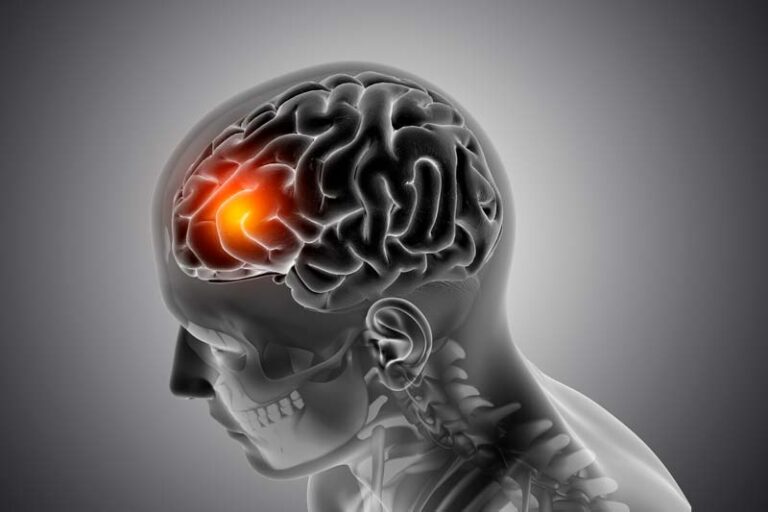 Neurofeedback Helps Traumatic Brain Injuries and Concussions